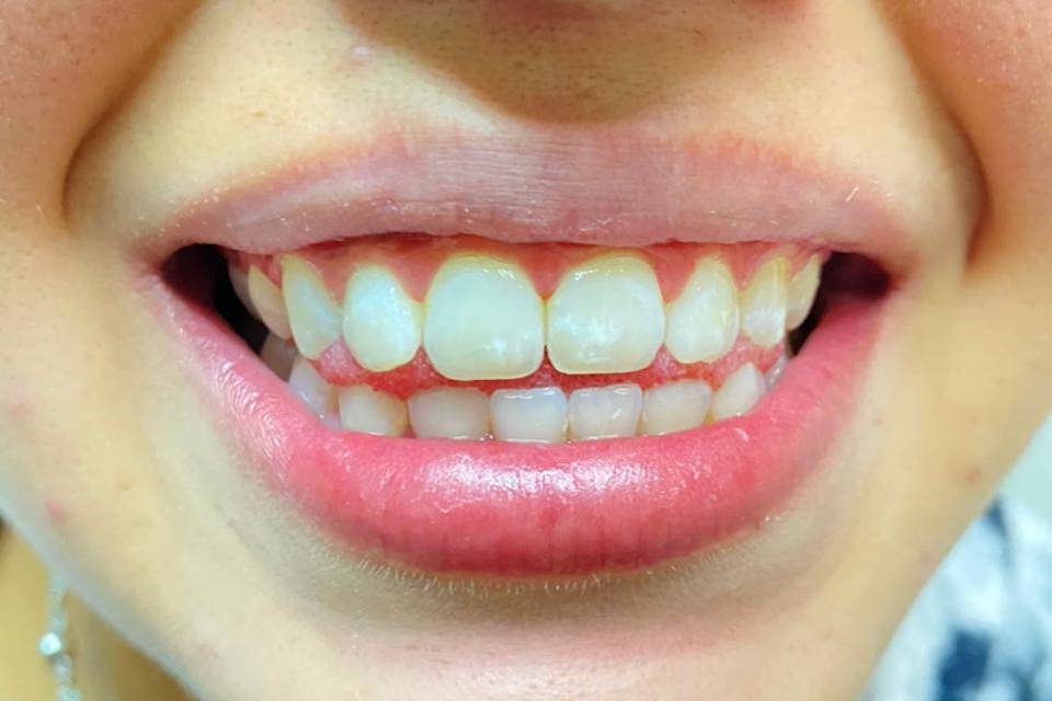 Alto Olivar Dental, Belleza
