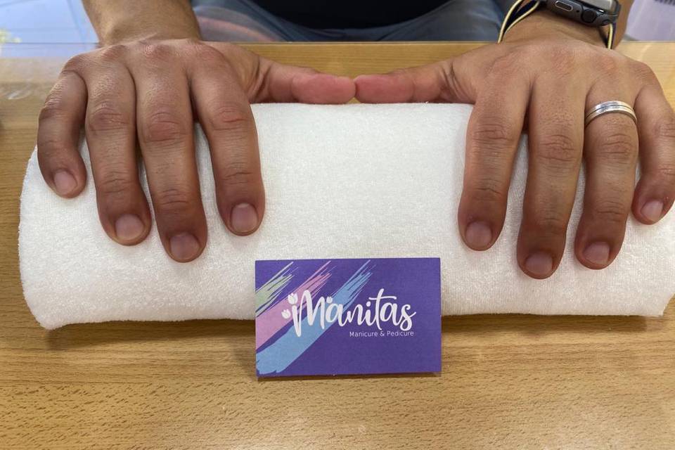 Manitas, Belleza